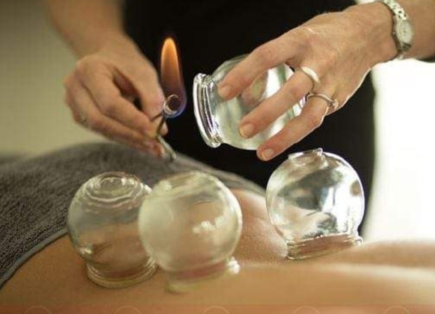 كورس تعلم الحجامة - Cupping therapy